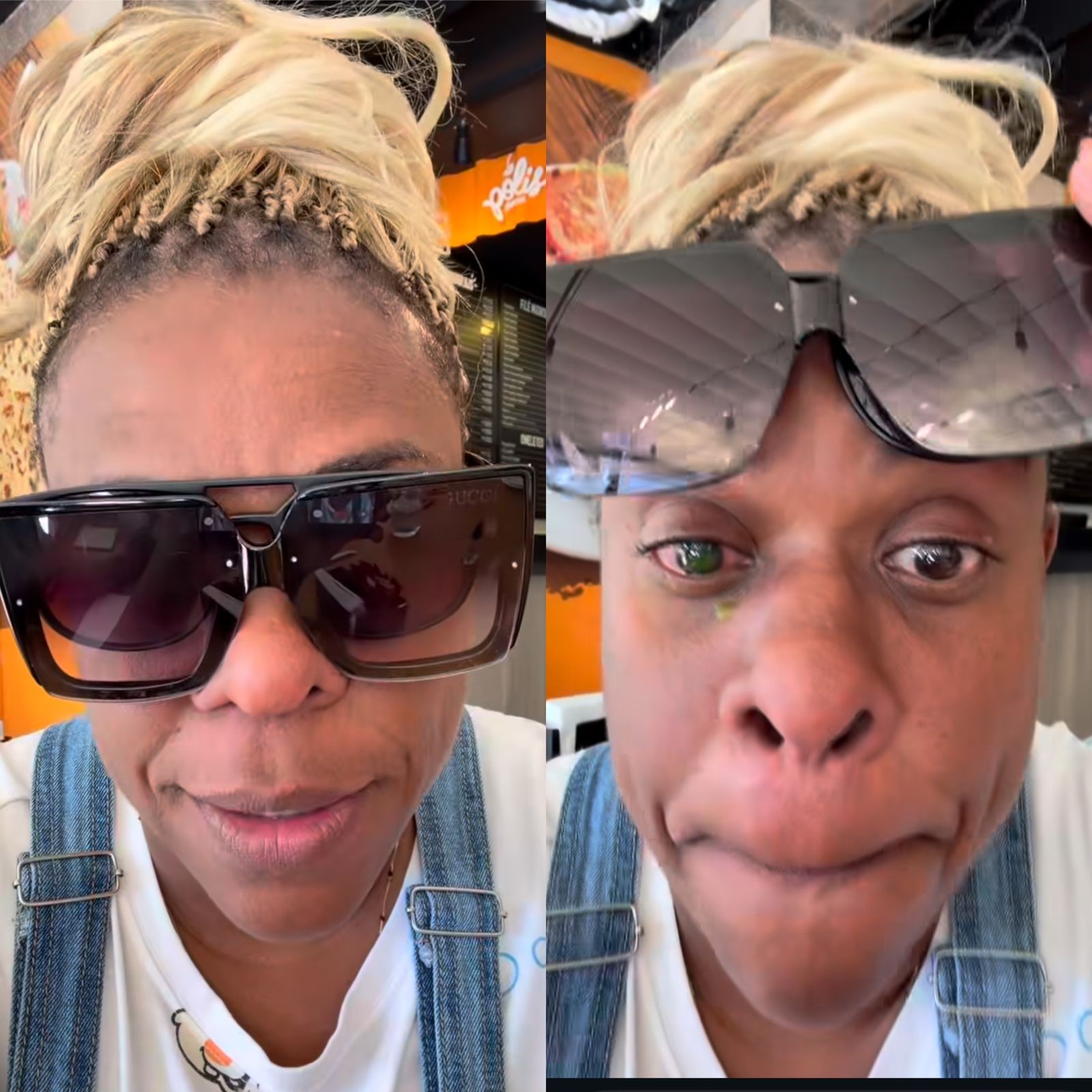 Cacau Protásio tem reação alérgica grave nos olhos após uso de pomada capilar: 'Achei que fosse ficar cega'