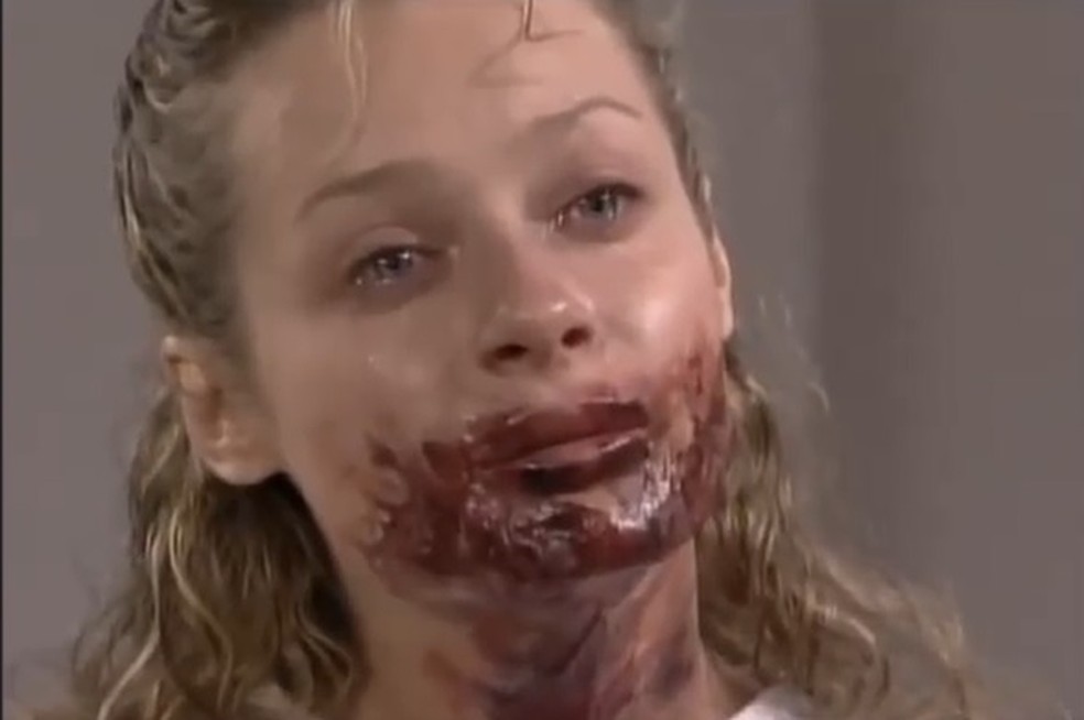 Em Amigas e Rivais, Rosana Delaor (Joana Benedek) fica desfigurada — Foto: Reprodução