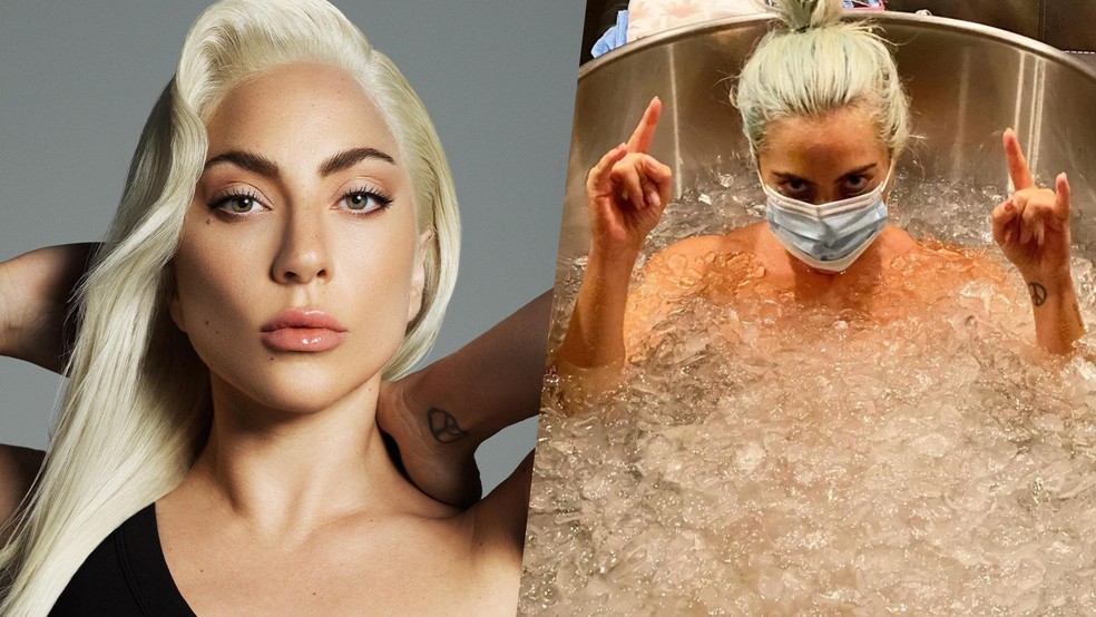 Lady Gaga revelou diagnóstico de fibromialgia em 2013 — Foto: Reprodução/Instagram