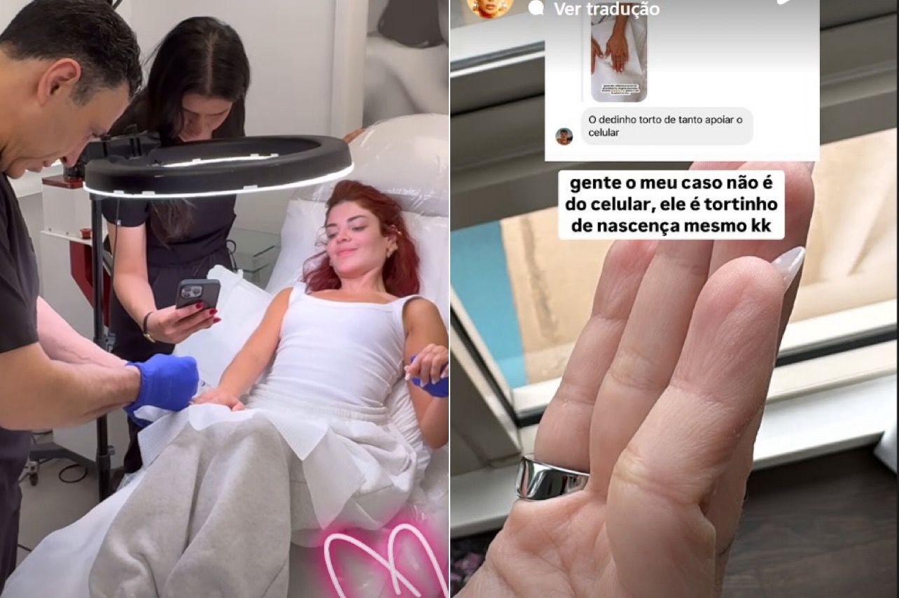 Gkay rebate internauta que fez comentário sobre seu dedo: 'Tortinho de nascença'