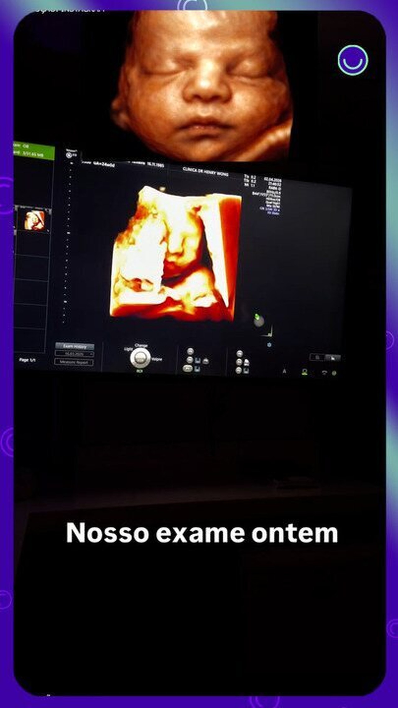 Patrícia Leitte mostra rosto do filho em ultrassom: 'Nosso coração transbordou de amor'