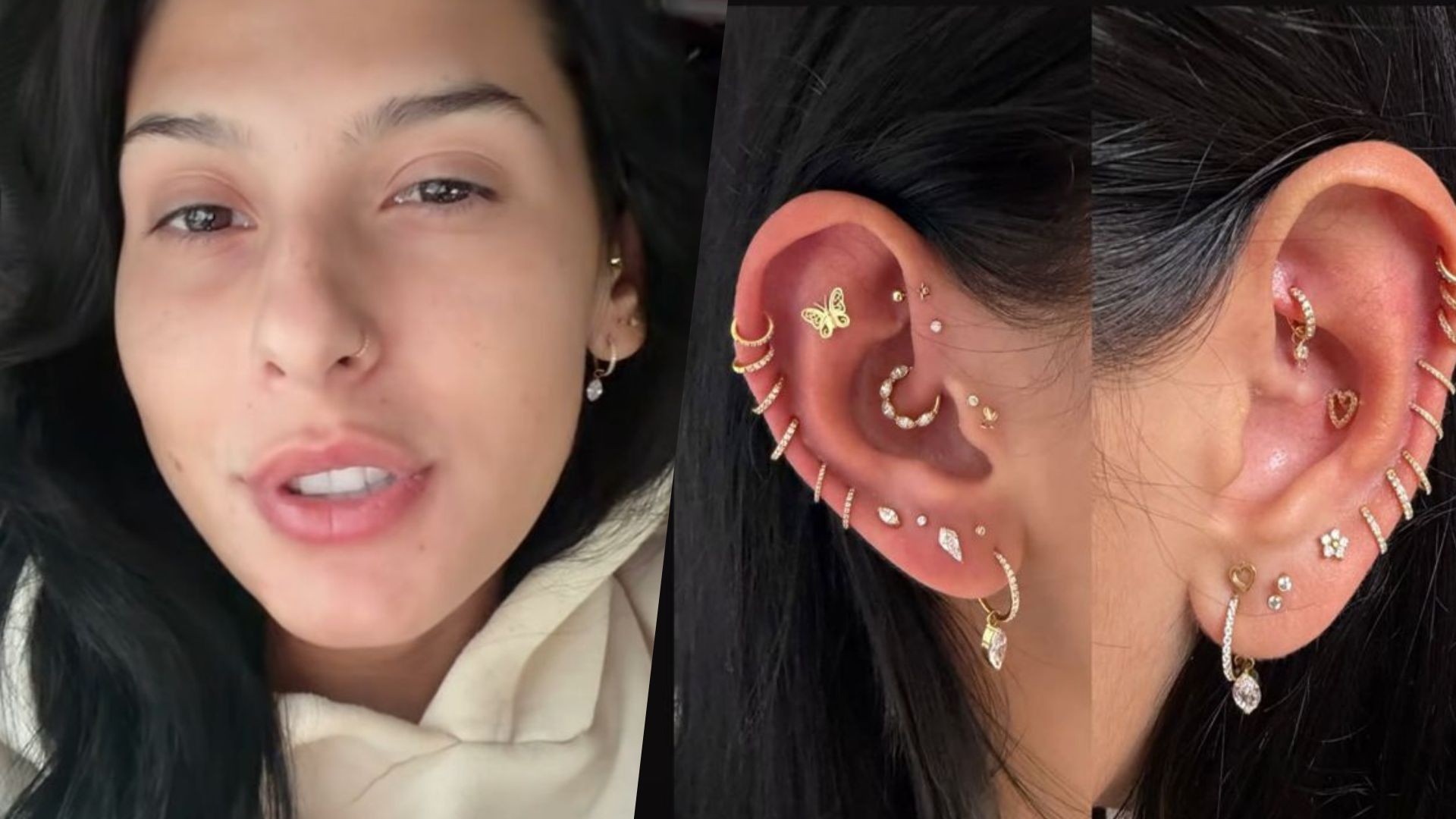 Após adiar cirurgia plástica nas orelhas, Ana Castela troca todos os piercings