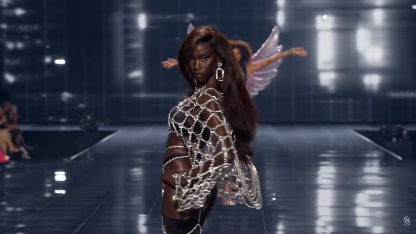 Modelo do Ano, Anok Yai revela condição que afeta coração e pulmões e passa por cirurgia