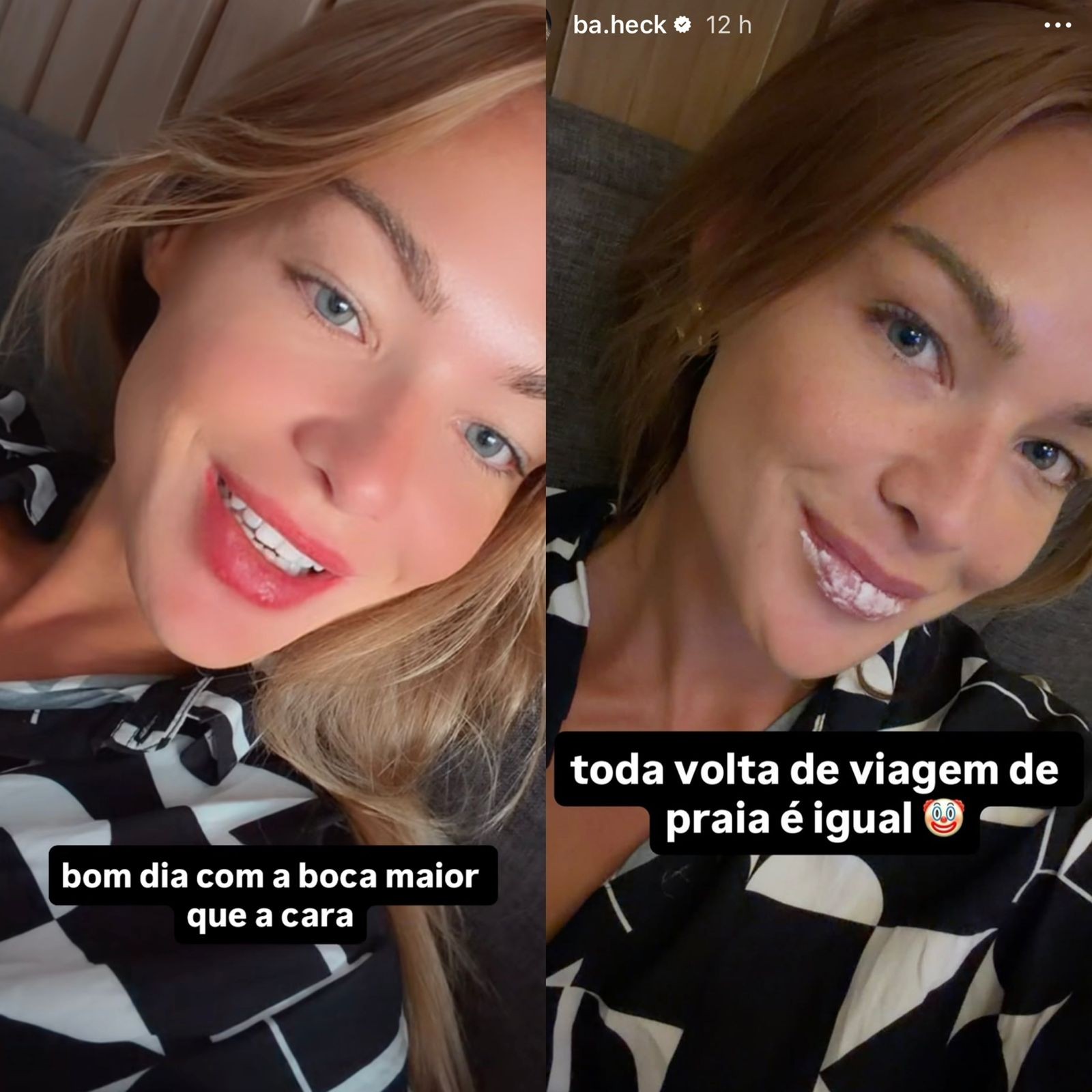 Ex-BBB Bárbara Heck revela estar com herpes na boca: ‘Mostrando aqui para vocês também não terem vergonha’