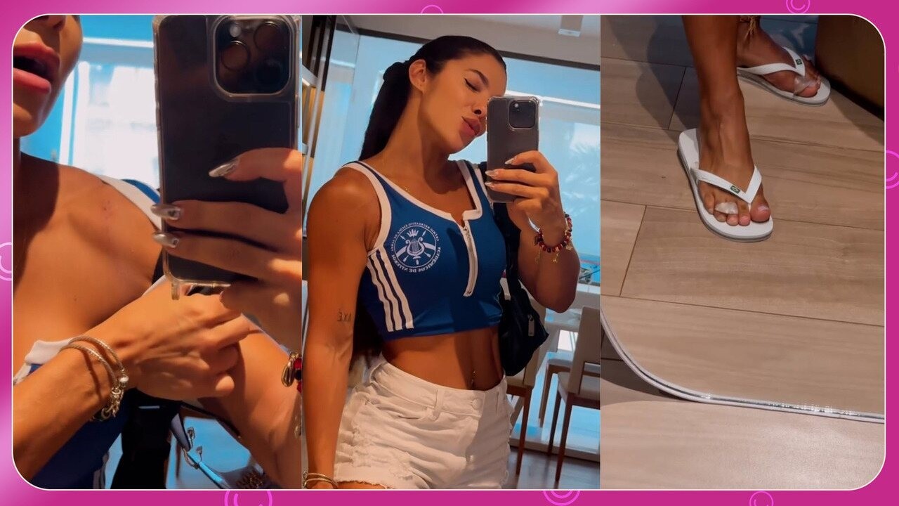 Monique Rizzeto, dona do bumbum desenhado, mostra machucados do ...