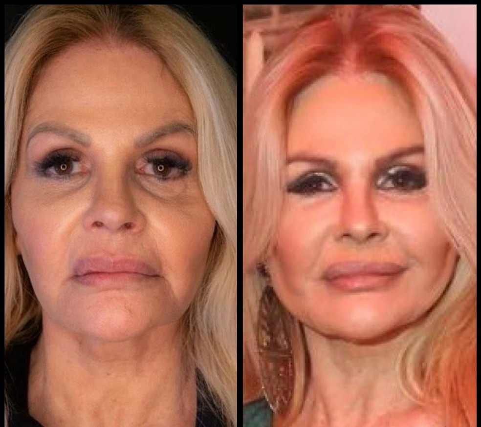 Monique Evans fez procedimentos estéticos no rosto antes de subir ao altar — Foto: Instagram