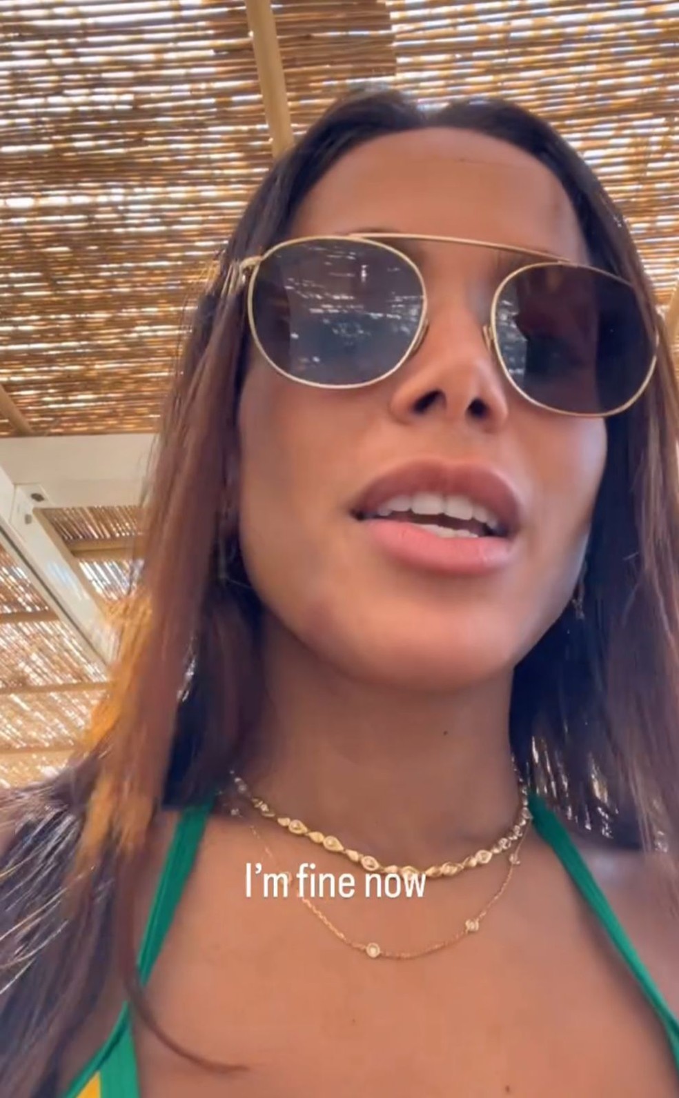 Anitta diz que está bem após sofrer queimadura por água-viva — Foto: Reprodução/Instagram