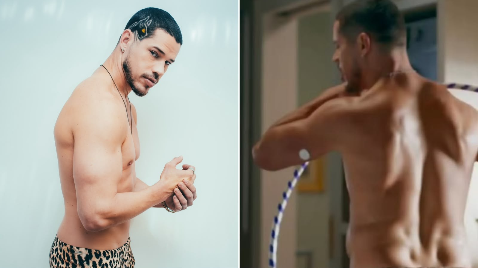 José Loreto exibe sensor de glicose em novela: 'Anos escondendo' | Gshow