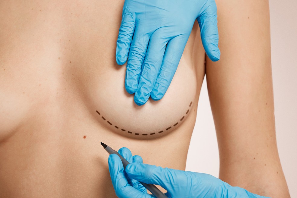 Cirurgia das mamas no verão pode ter recuperação rápida