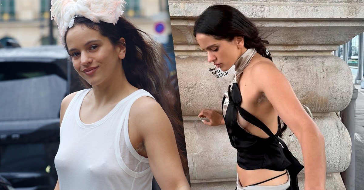 Pelos das axilas descoloridos: médica alerta para cuidados e riscos