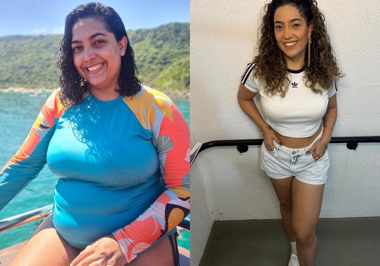 Após perder 40kg, Camila Moura, ex de Lucas Buda, vai fazer três cirurgias plásticas