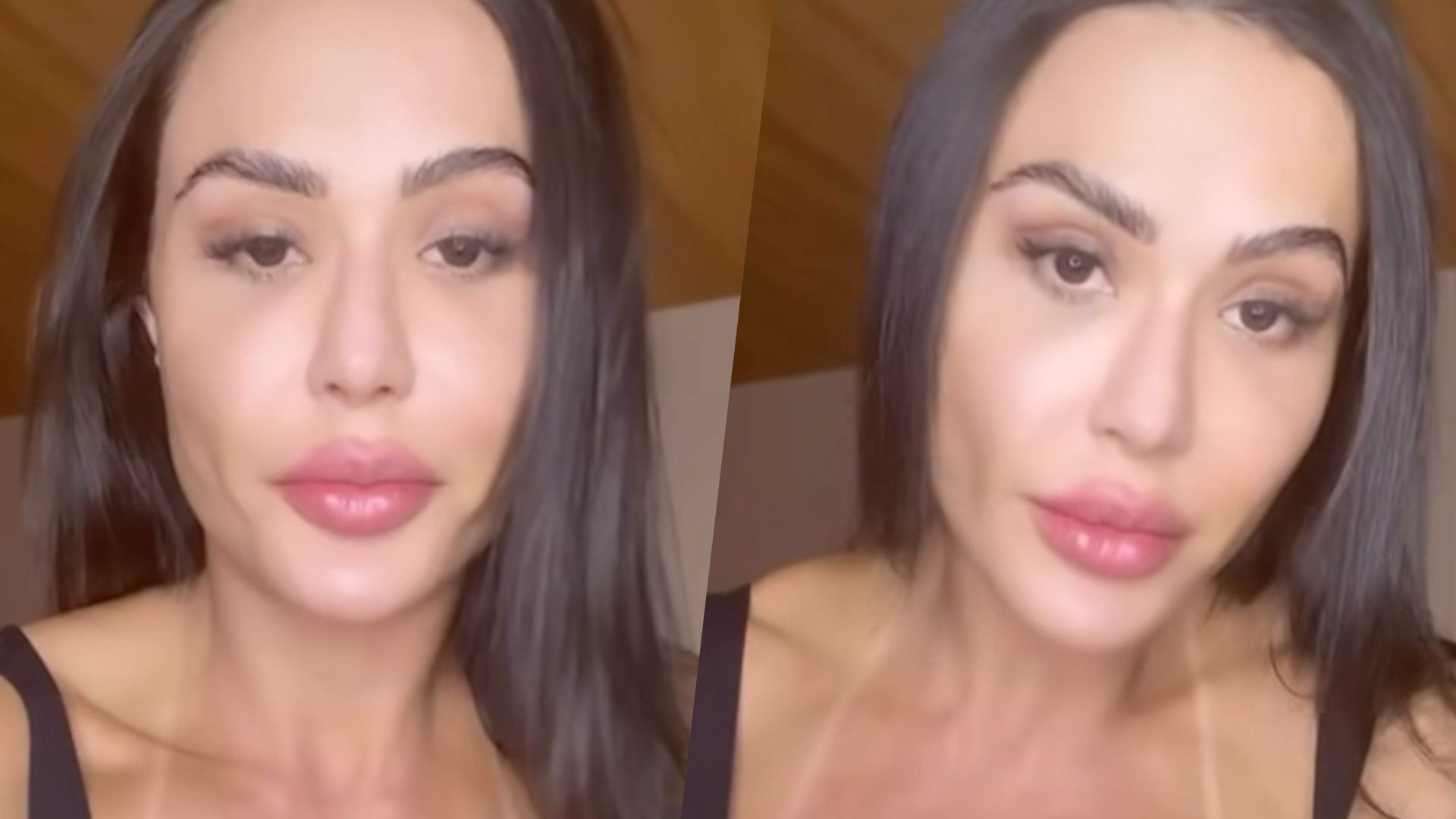 Gracyanne Barbosa desabafa sobre processo pós-cirúrgico: 'Zero vontade de treinar'