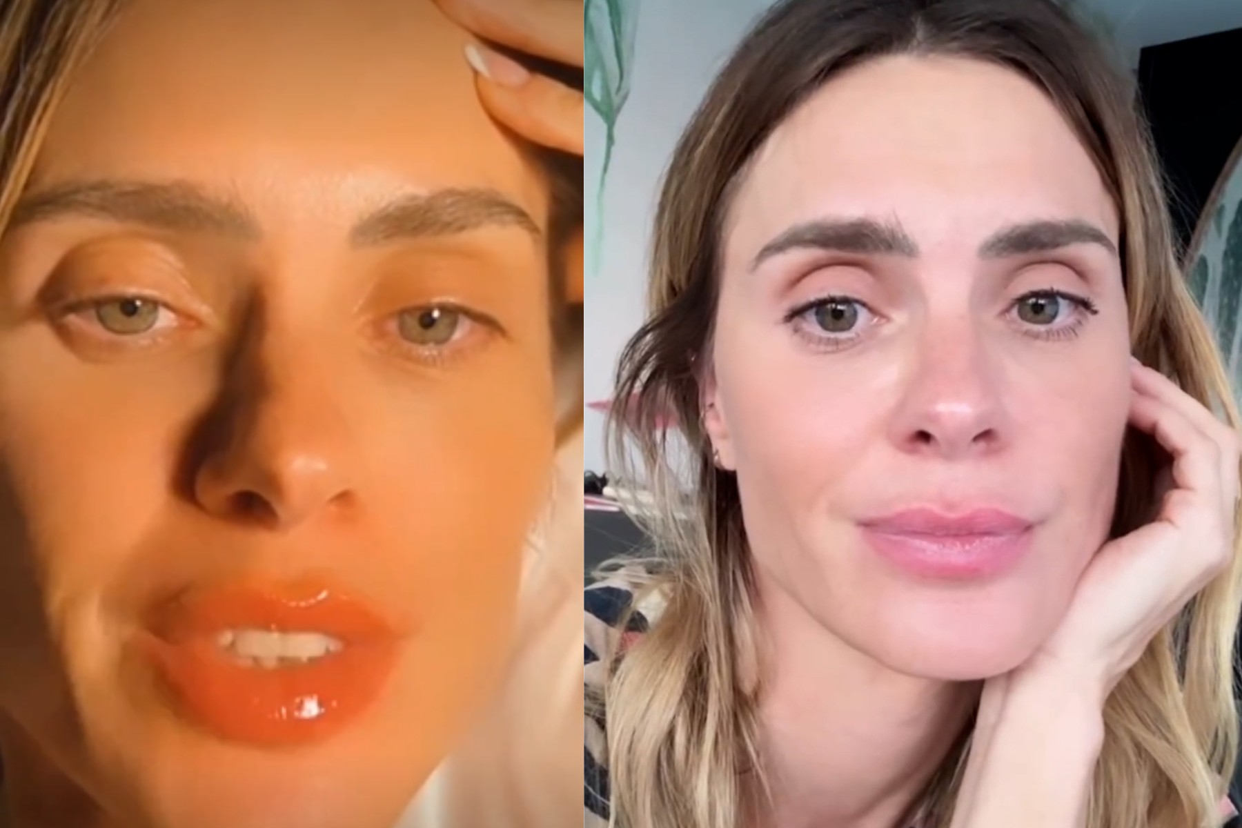 Carolina Dieckmann ironiza acusações de ter feito preenchimento labial: 'Nossa! Minha boca voltou ao normal'