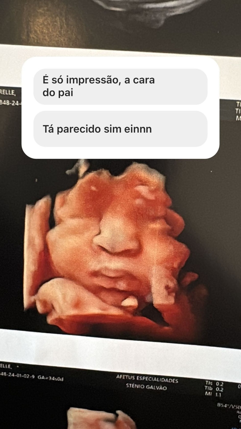 Ultrassonografia de Jorge, bebê de Ary Mirelle e João Gomes — Foto: Instagram