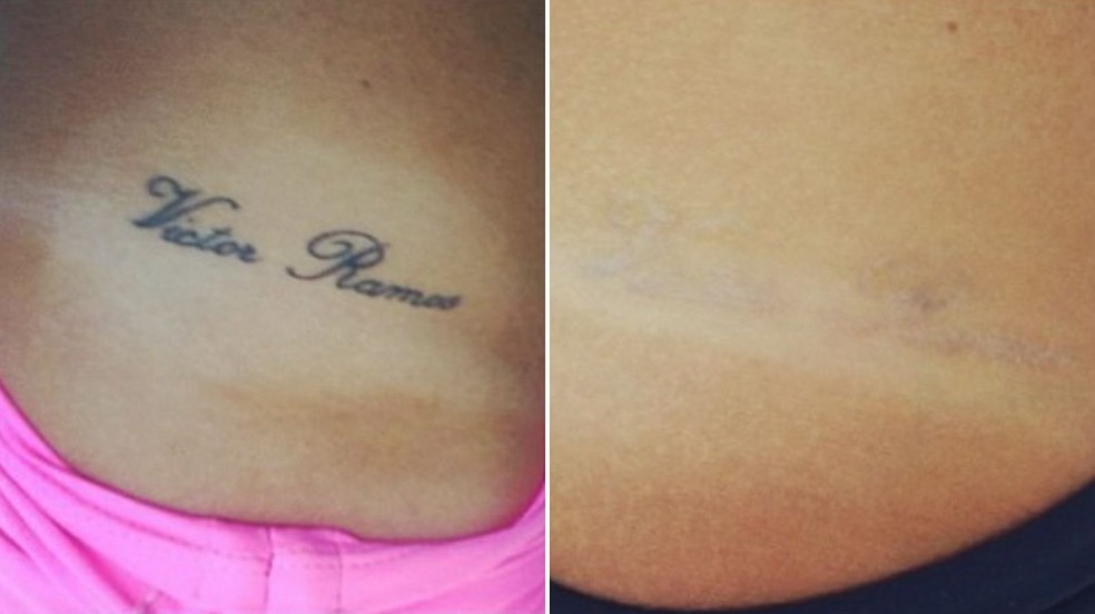 Nicole Bahls removeu tatuagem que fez para o ex Victor Ramos — Foto: Reprodução/Instagram