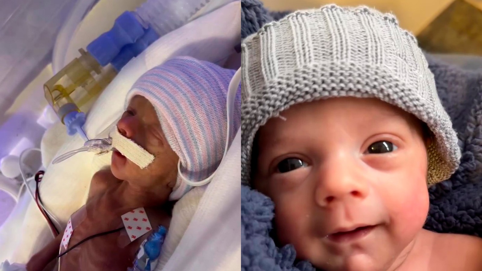 Clara Maia mostra evolução do filho prematuro que está há mais de um mês na UTIN