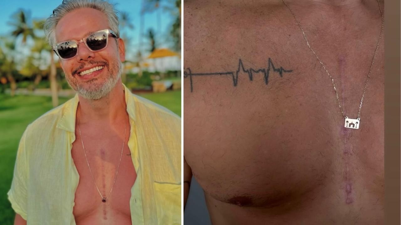 Otaviano Costa exibe cicatriz de cirurgia cardíaca: 'Meu símbolo de renascimento'