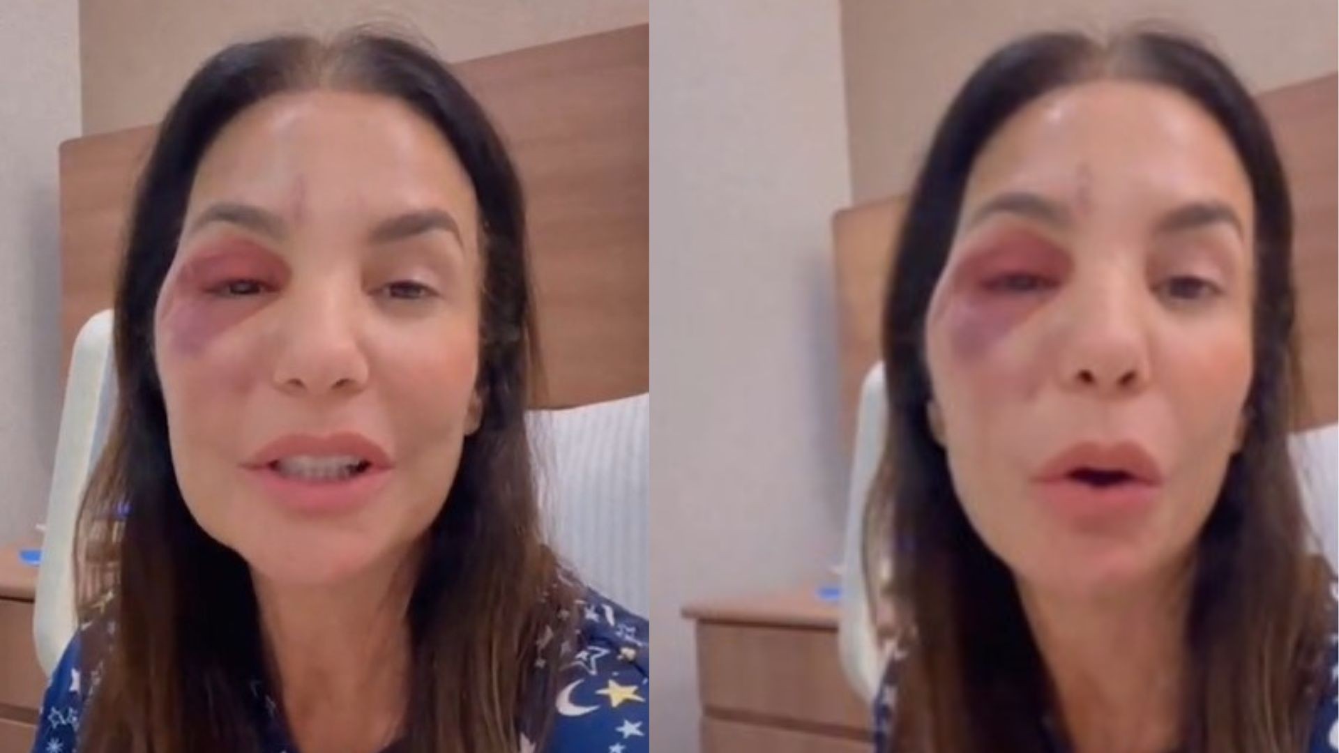 Após cirurgia, Ivete Sangalo atualiza seu estado de saúde