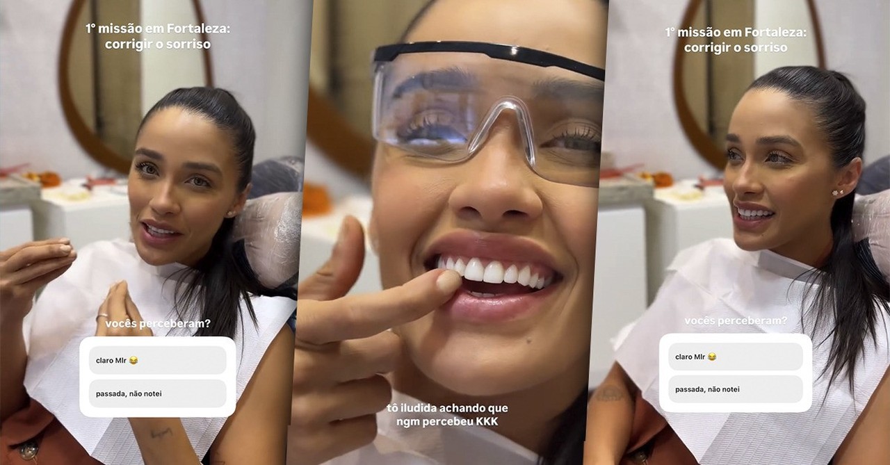 Eva recupera dente quebrado e brinca: ‘Ainda bem que ninguém percebia’