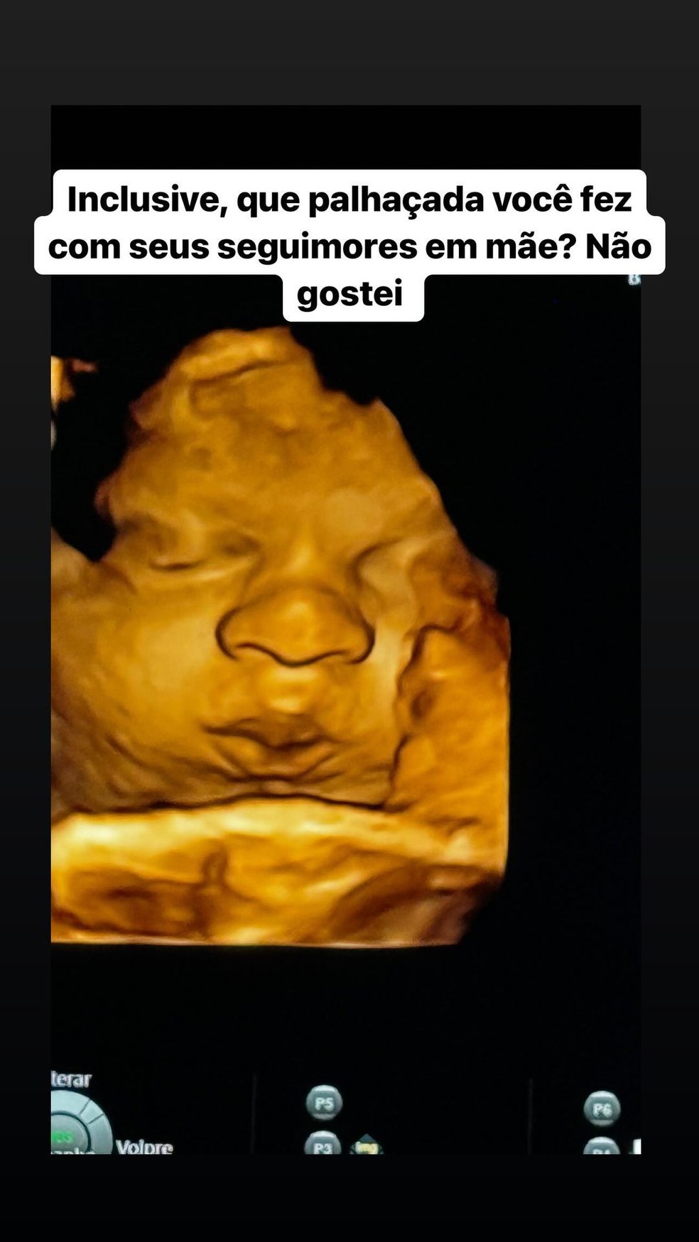 Ultrassonografia de Jorge, bebê de Ary Mirelle e João Gomes — Foto: Instagram