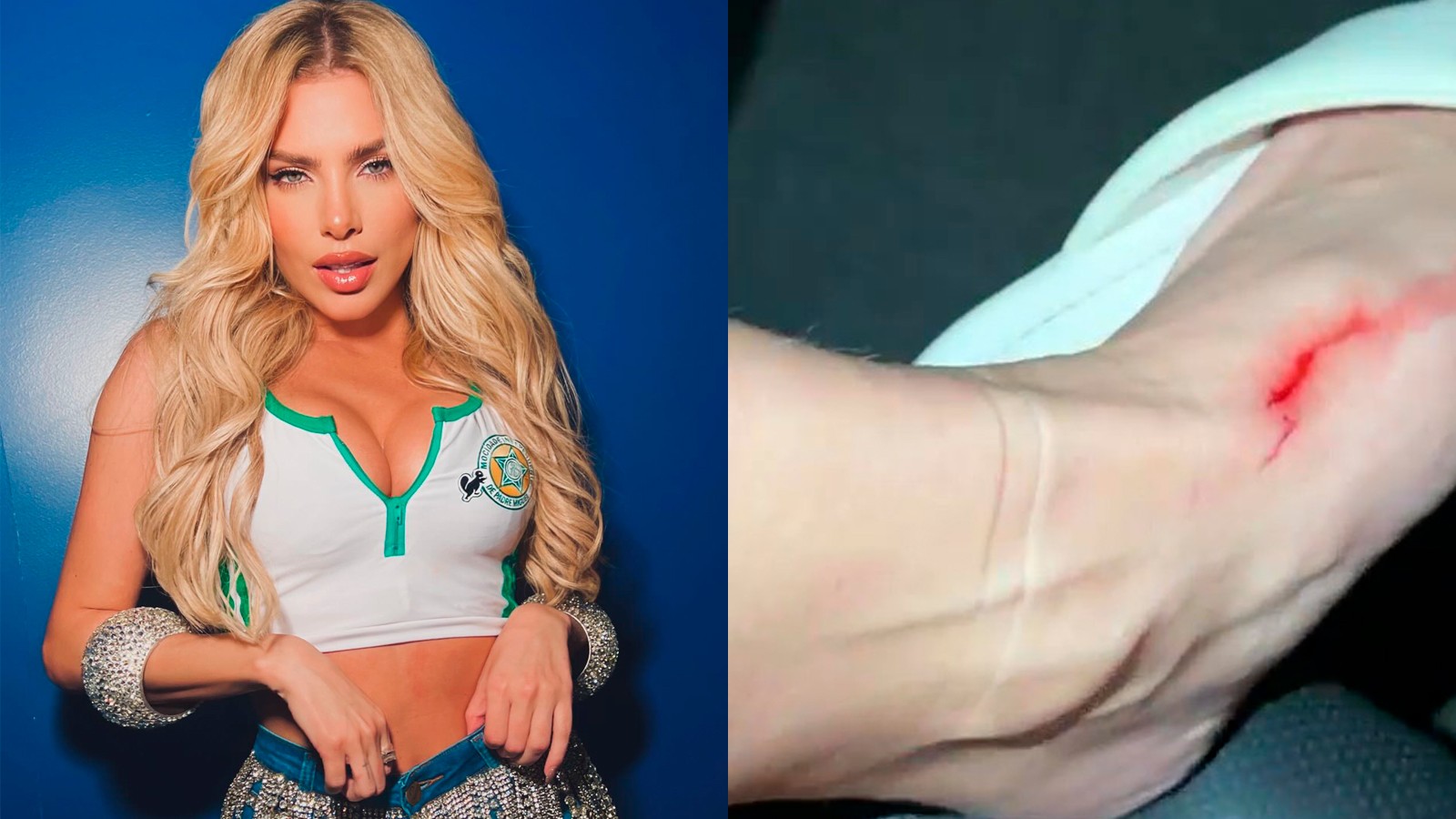 Musa da Mocidade , Erika Schneider corta o pé após ensaio de rua :  Voou caco de vidro pra todo lugar  