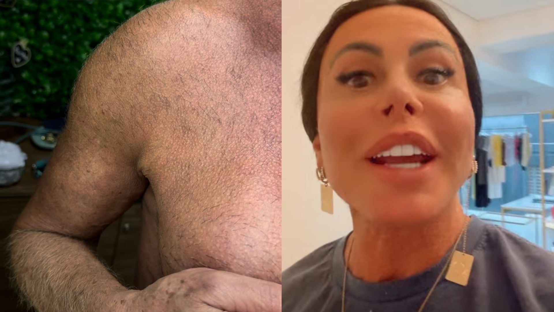 Gretchen mostra clareamento de pelos e rebate críticas nas redes | Gshow