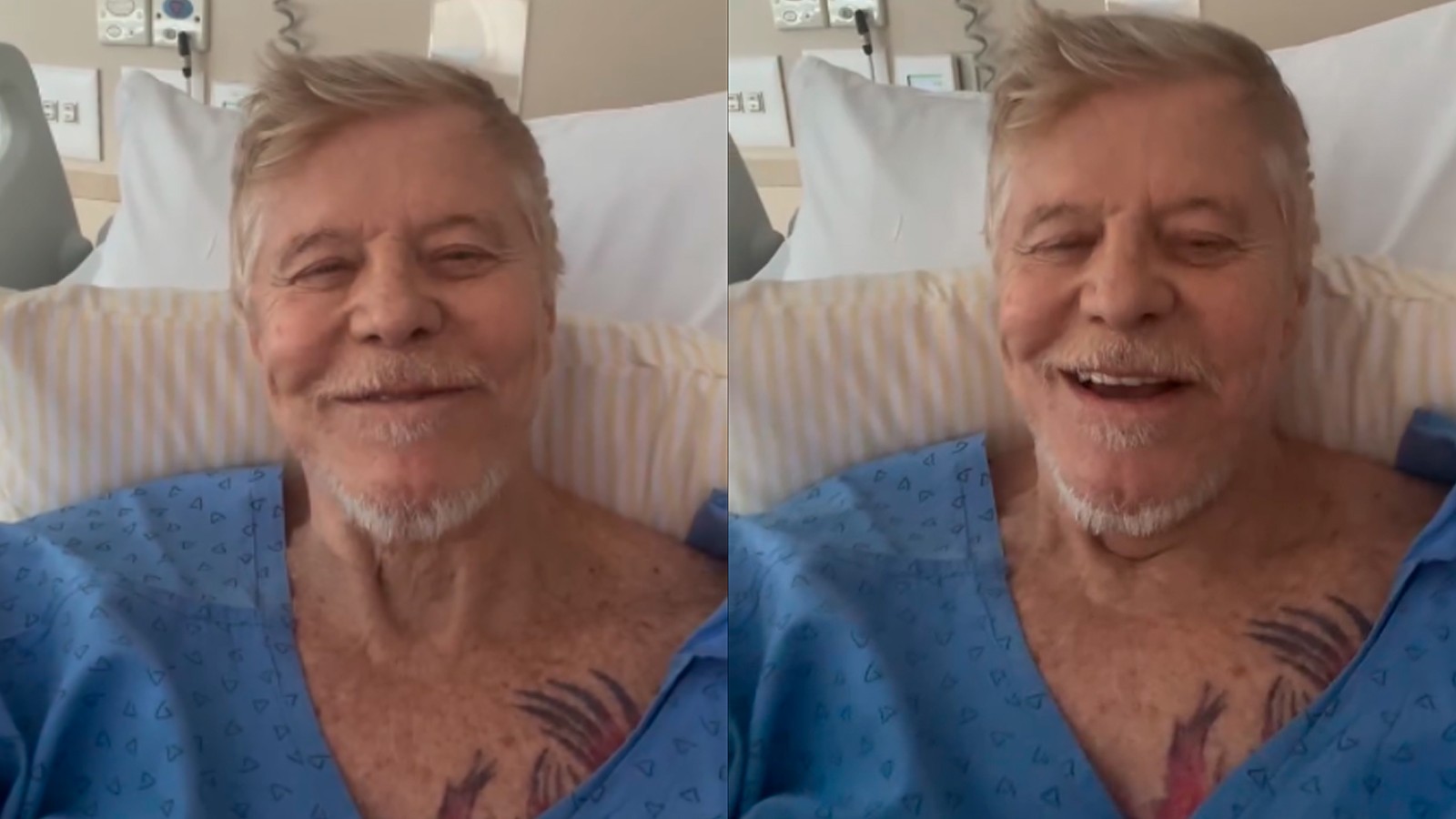 Miguel Falabella conta que passou por cirurgia após fortes dores na coluna e agradece mensagens de carinho