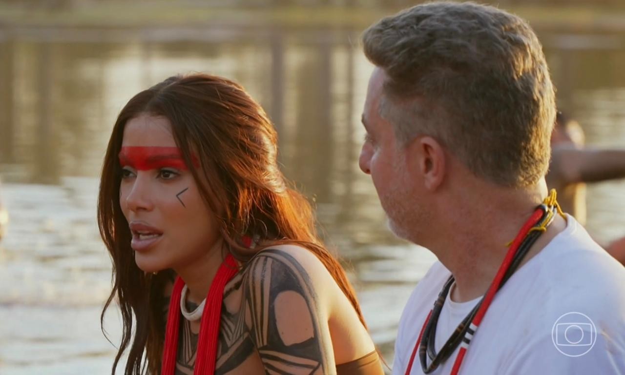 Anitta rebate críticas por plásticas: 'Não é porque estou espiritualizada que não posso fazer'