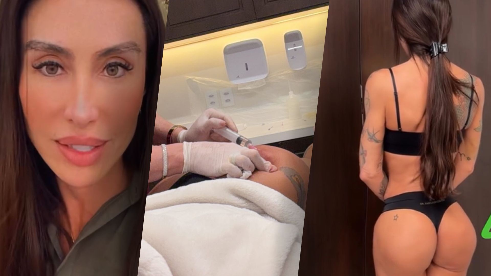 Jaque Khury fala de retirada de nódulos nos glúteos após procedimento com 'técnica errada'