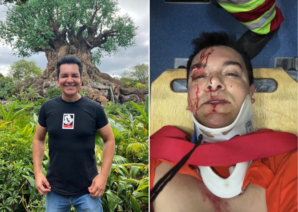 Regis Danese é avaliado e realiza exames após acidente a caminho de show em Goiás — Foto: Instagram/Reprodução