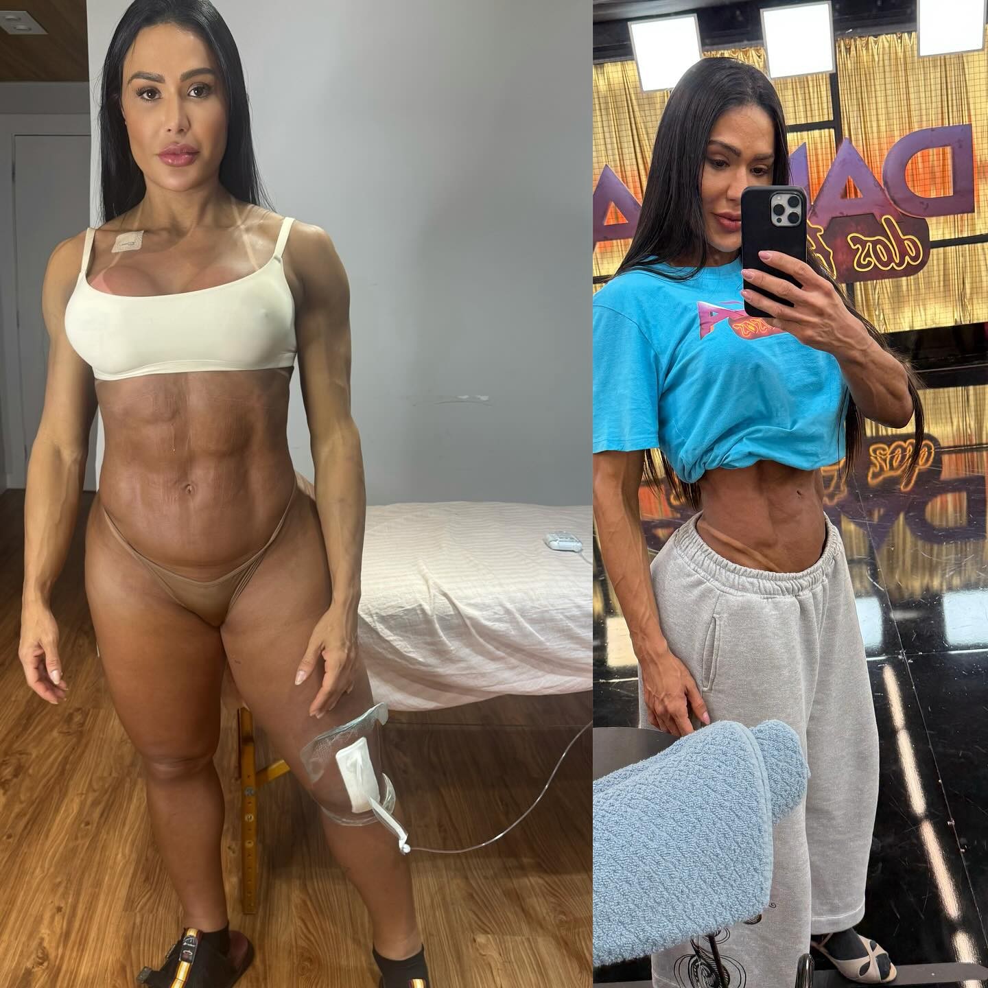 Gracyanne Barbosa mostra o corpo antes e depois de participar do 'Dança dos Famosos' e esclarece polêmica