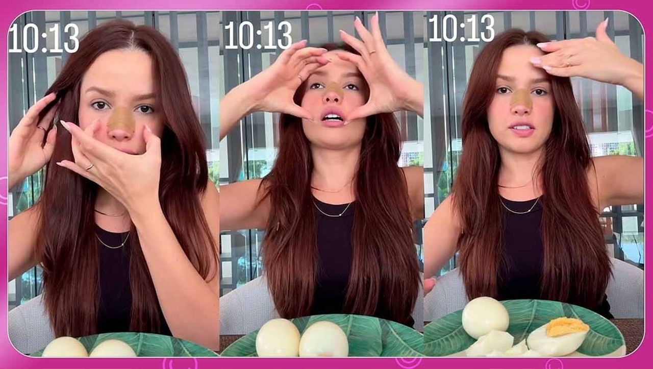 Juliette atualiza estado após fraturar o nariz ao bater com o rosto na porta: 'Achei que ia acordar toda roxa'