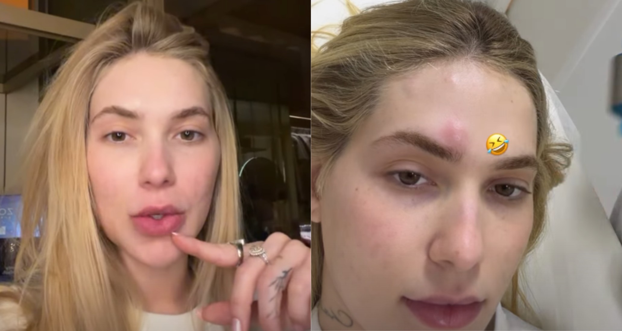 Virginia faz desabafo sobre enxaqueca e dá detalhes de tratamento: 'Sem ânimo para nada'