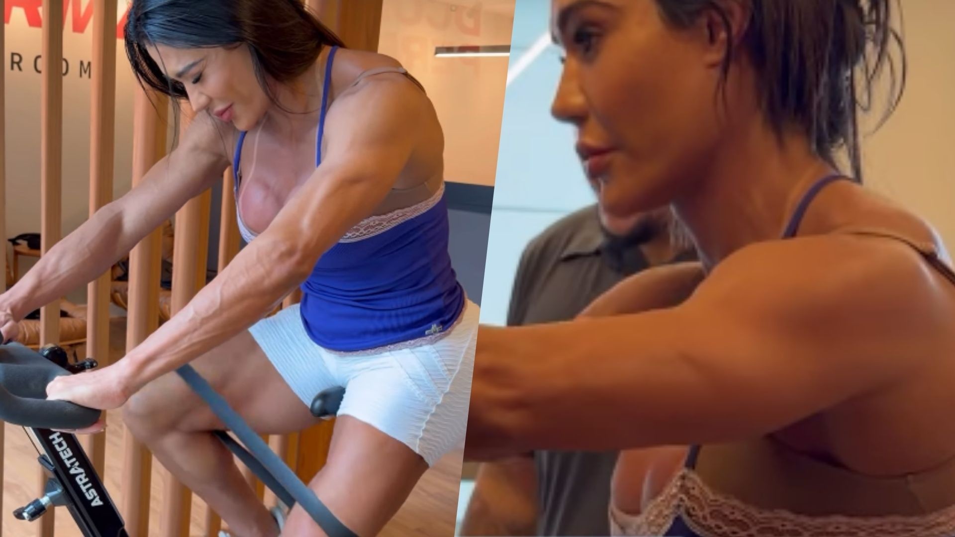 Gracyanne Barbosa fala da recuperação do joelho após cirurgia: 'Tratamento intenso'