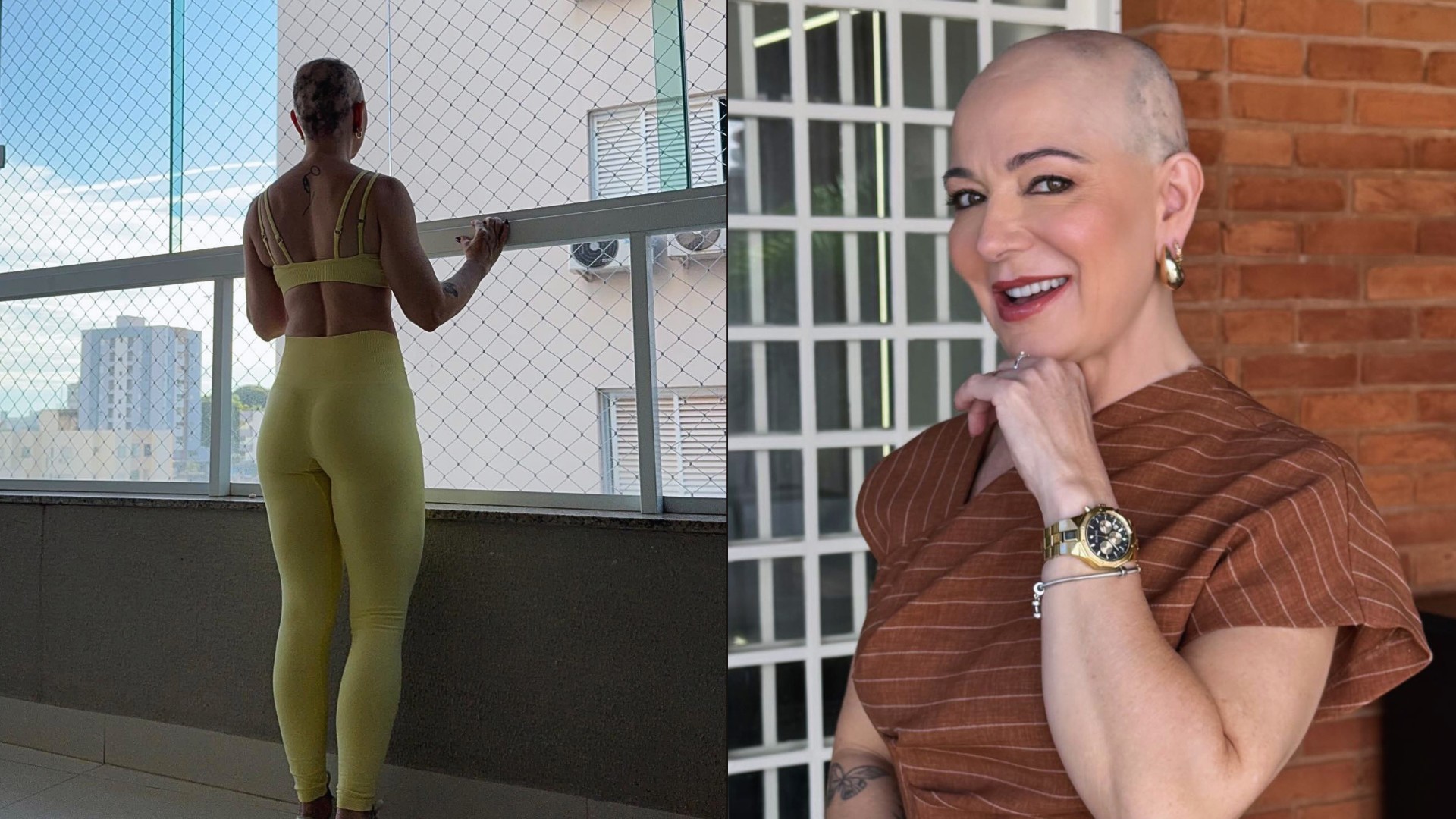 Karina Lucco brinca sobre novo visual em meio a tratamento contra alopecia: 'É cabelo na nuca!'
