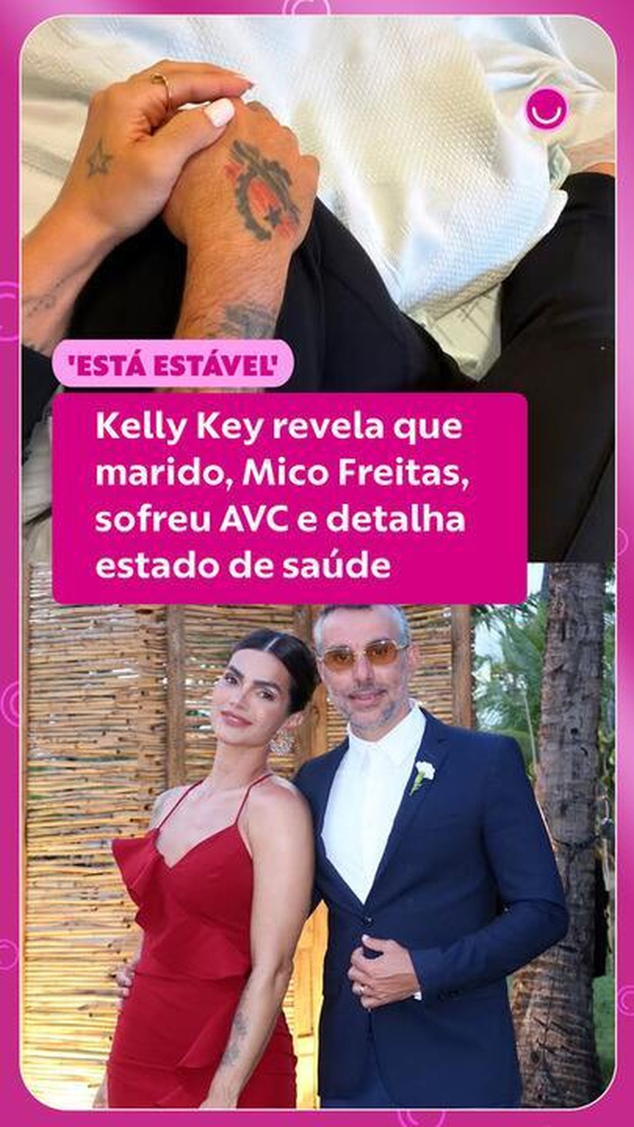 AVC em pessoas mais novas: médico explica causas e como prevenir