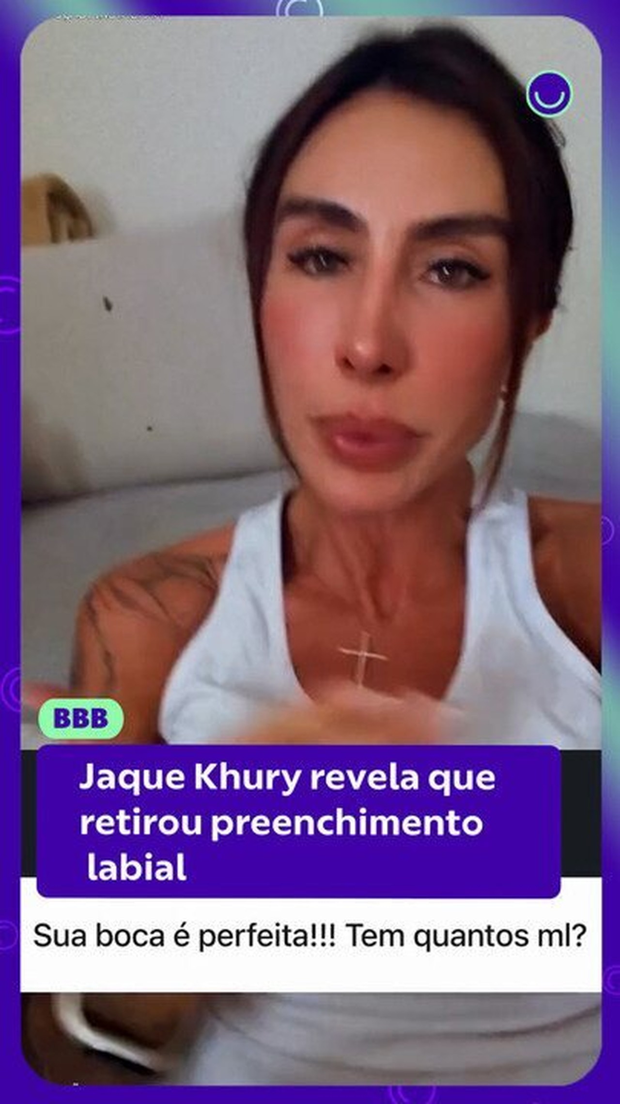 Jaque Khury revela que retirou preenchimento labial: 'Usei por muito tempo'