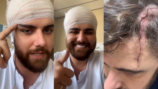 Zé Neto mostra o corte que sofreu em um acidente doméstico — Foto: Reprodução/Redes sociais